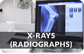 X-RAYS(RADIOGRAPHS)